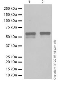 Western blot - Anti-STK33 antibody [EPR15343] (AB206296), expandable thumbnail