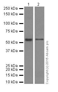 Western blot - Anti-STK33 antibody [EPR15343] (AB206296), expandable thumbnail