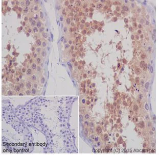Immunohistochemistry (Formalin/PFA-fixed paraffin-embedded sections) - Anti-STK33 antibody [EPR15343] - BSA and Azide free (AB251446)