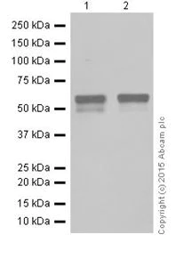 Western blot - Anti-STK33 antibody [EPR15343] - BSA and Azide free (AB251446)