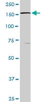 Western blot - Anti-STK36 antibody (AB103807)