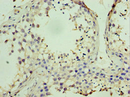 Immunohistochemistry (Formalin/PFA-fixed paraffin-embedded sections) - Anti-STK38 antibody (AB238340)