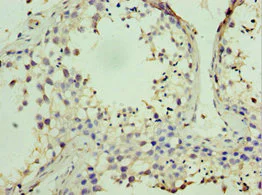 Immunohistochemistry (Formalin/PFA-fixed paraffin-embedded sections) - Anti-STK38 antibody (AB238340)