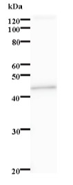 Western blot - Anti-STK38L/Ndr2 antibody [3563C2a] (AB84873)