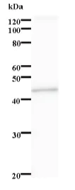 Western blot - Anti-STK38L/Ndr2 antibody [3563C2a] (AB84873)