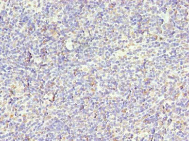 Immunohistochemistry (Formalin/PFA-fixed paraffin-embedded sections) - Anti-STK38L/Ndr2 antibody (AB235304)