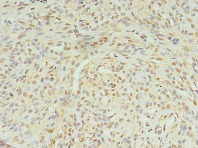 Immunohistochemistry (Formalin/PFA-fixed paraffin-embedded sections) - Anti-STK38L/Ndr2 antibody (AB235304)