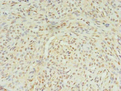 Immunohistochemistry (Formalin/PFA-fixed paraffin-embedded sections) - Anti-STK38L/Ndr2 antibody (AB235304)