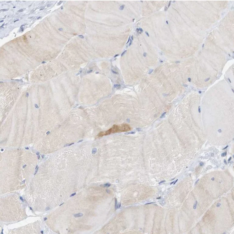 Immunohistochemistry (Formalin/PFA-fixed paraffin-embedded sections) - Anti-STMN3 antibody (AB224257)