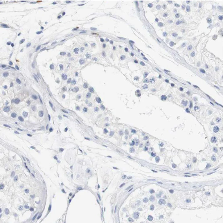 Immunohistochemistry (Formalin/PFA-fixed paraffin-embedded sections) - Anti-STMN3 antibody (AB224257)