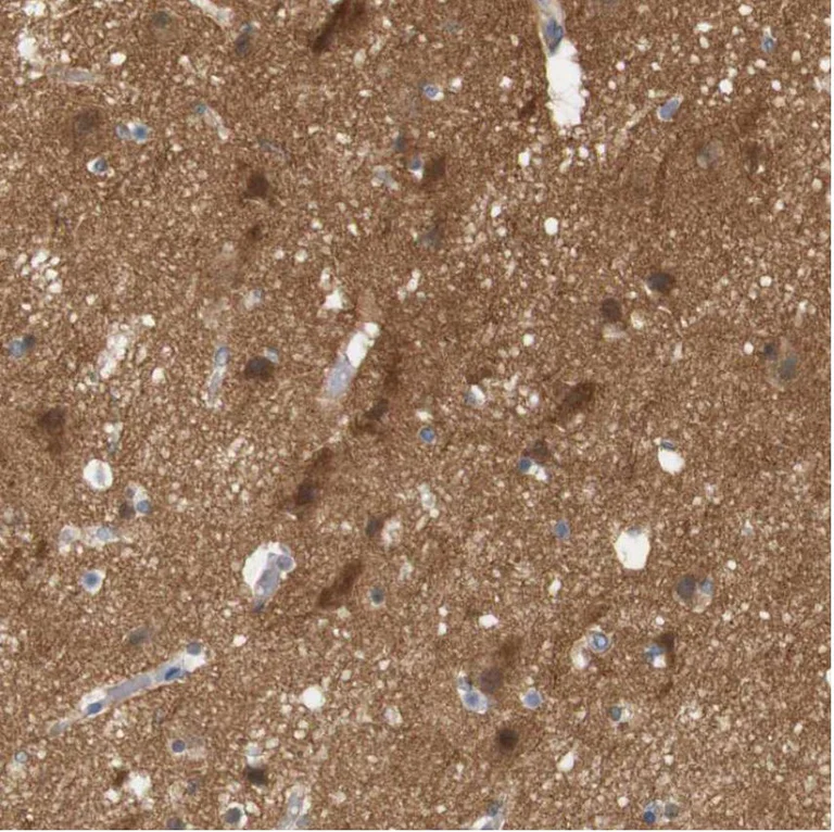 Immunohistochemistry (Formalin/PFA-fixed paraffin-embedded sections) - Anti-STMN3 antibody (AB224257)