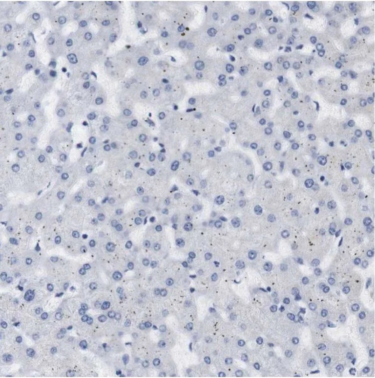 Immunohistochemistry (Formalin/PFA-fixed paraffin-embedded sections) - Anti-STMN3 antibody (AB224257)