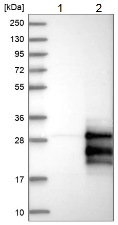Western blot - Anti-STMN3 antibody (AB224257)