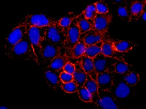 Immunocytochemistry/ Immunofluorescence - Anti-Stomatin antibody [EPR10420] (AB169524), expandable thumbnail