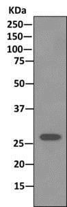 Western blot - Anti-Stomatin antibody [EPR10420] (AB169524), expandable thumbnail
