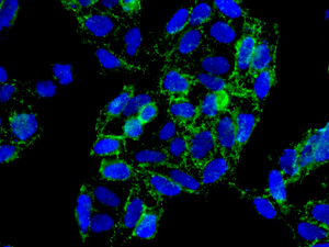 Immunocytochemistry/ Immunofluorescence - Anti-Stomatin antibody [EPR10421] (AB166623)