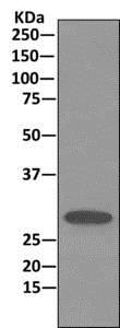 Immunoprecipitation - Anti-Stomatin antibody [EPR10421] (AB166623)