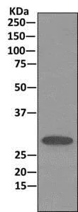 Immunoprecipitation - Anti-Stomatin antibody [EPR10421] - BSA and Azide free (AB249361)
