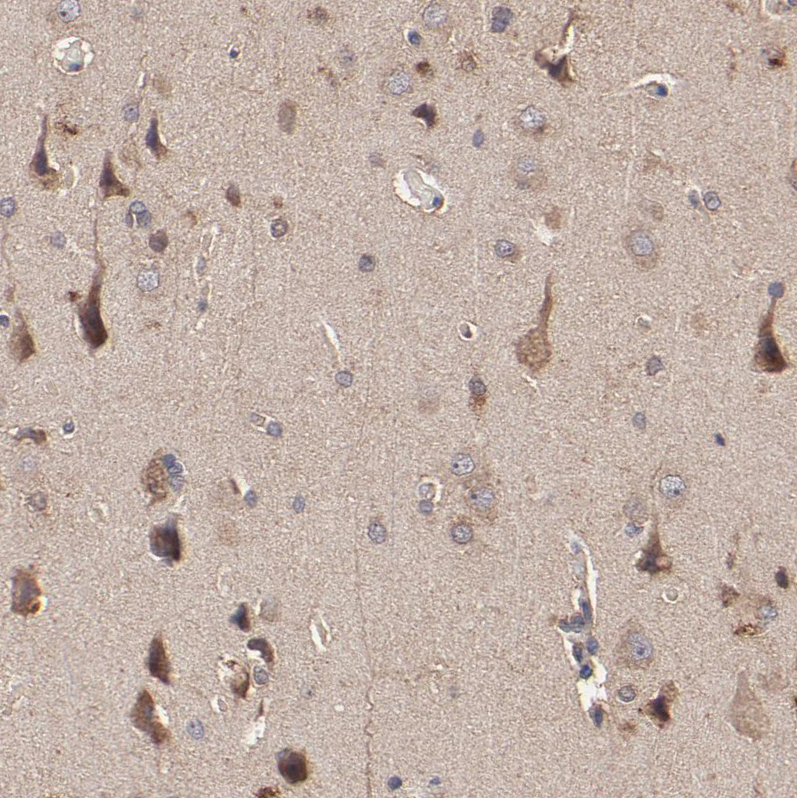Immunohistochemistry (Formalin/PFA-fixed paraffin-embedded sections) - Anti-STON2 antibody (AB121165)