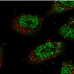Immunocytochemistry/ Immunofluorescence - Anti-STOX1 antibody (AB122420), expandable thumbnail