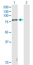 Western blot - Anti-Stra6 antibody (AB169600), expandable thumbnail