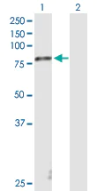 Western blot - Anti-Stra6 antibody (AB169600)