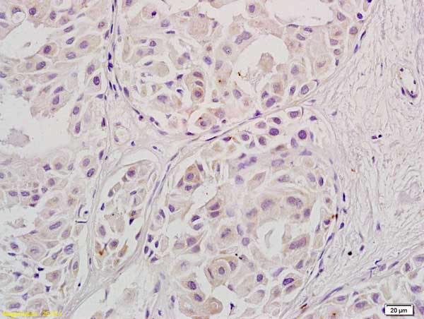 Immunohistochemistry (Formalin/PFA-fixed paraffin-embedded sections) - Anti-Stra8 antibody (AB217380), expandable thumbnail