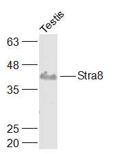 Western blot - Anti-Stra8 antibody (AB217380), expandable thumbnail