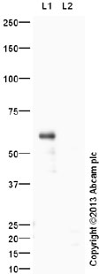 Western blot - Anti-Stra8 antibody (AB49405), expandable thumbnail