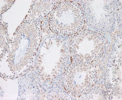 Immunohistochemistry (Formalin/PFA-fixed paraffin-embedded sections) - Anti-Stra8 antibody (AB49602), expandable thumbnail