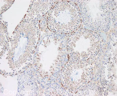 Immunohistochemistry (Formalin/PFA-fixed paraffin-embedded sections) - Anti-Stra8 antibody (AB49602)