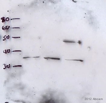 Western blot - Anti-Stra8 antibody (AB49602)