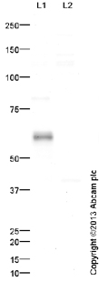 Western blot - Anti-Stra8 antibody (AB49602), expandable thumbnail
