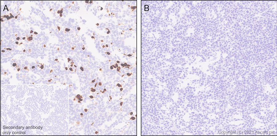 Immunohistochemistry - Anti-Stra8 antibody [EPR27083-56] (ab308124), expandable thumbnail