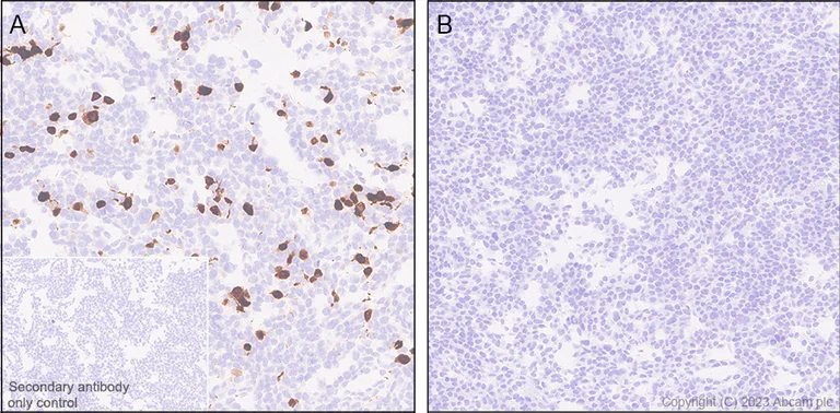 Immunohistochemistry - Anti-Stra8 antibody [EPR27083-56] - BSA and Azide free (AB308125)