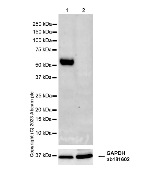 Western blot - Anti-Stra8 antibody [EPR27083-56] - BSA and Azide free (AB308125)