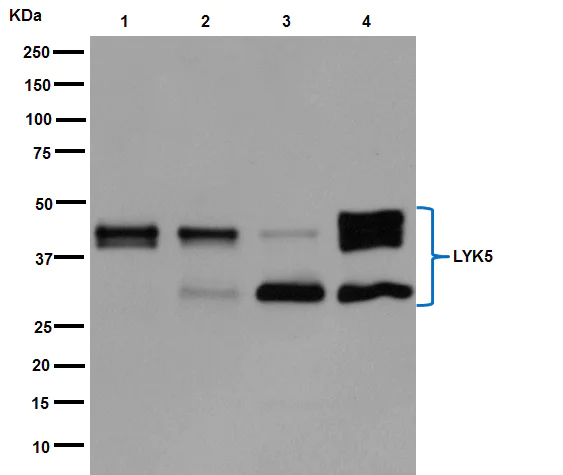 Western blot - Anti-STRAD antibody [EPR15603] (AB192879)