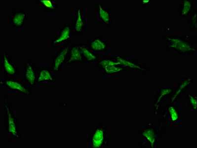 Immunocytochemistry/ Immunofluorescence - Anti-STRBP antibody (AB237682)