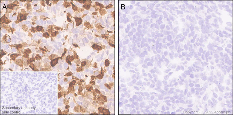 Immunohistochemistry (Formalin/PFA-fixed paraffin-embedded sections) - Anti-Strep-tag II antibody [EPR28119-43] (AB307676)