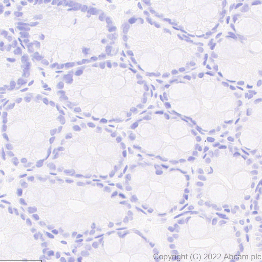 Immunohistochemistry (Formalin/PFA-fixed paraffin-embedded sections) - Anti-Strep-tag II antibody [EPR28119-43] (ab307676), expandable thumbnail