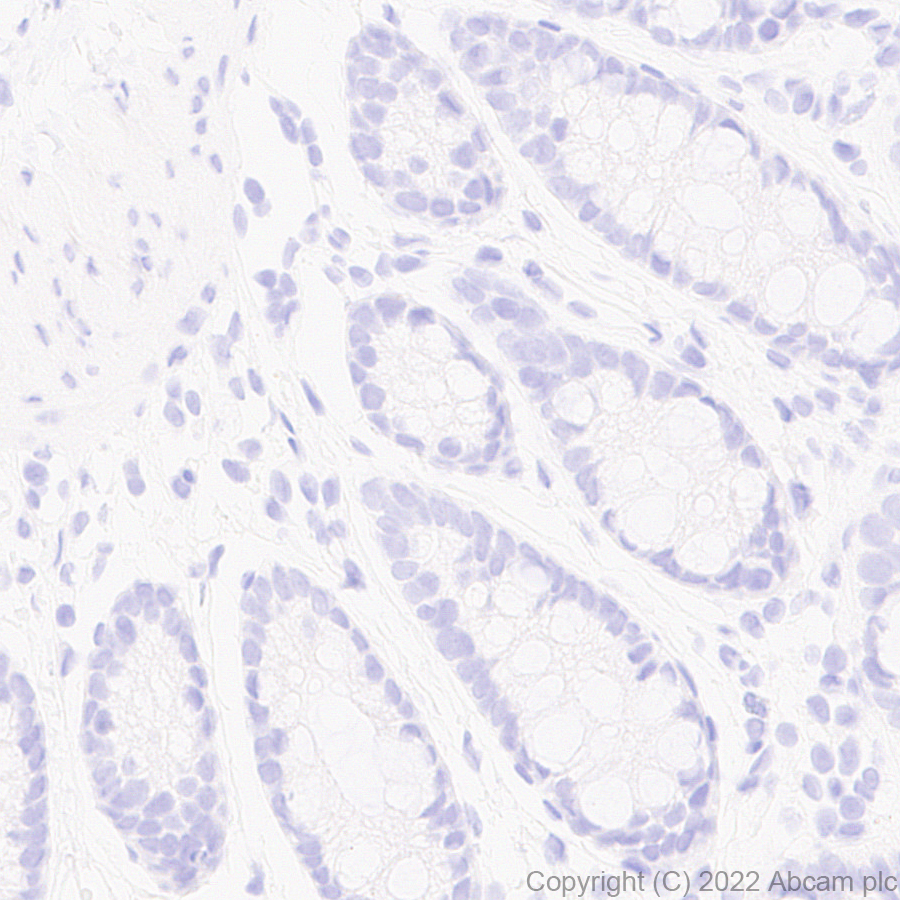 Immunohistochemistry (Formalin/PFA-fixed paraffin-embedded sections) - Anti-Strep-tag II antibody [EPR28119-43] (AB307676), expandable thumbnail