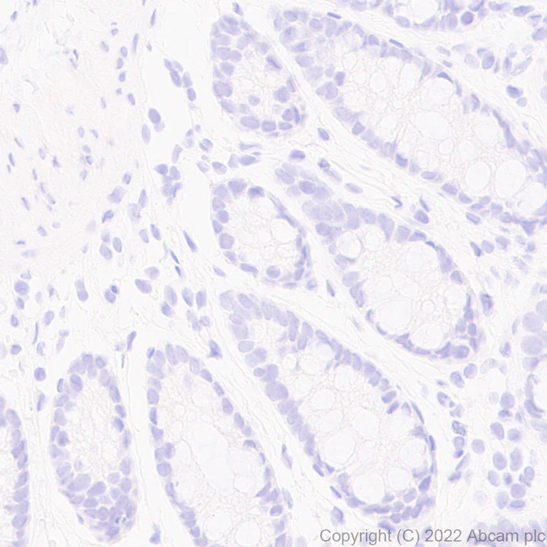 Immunohistochemistry (Formalin/PFA-fixed paraffin-embedded sections) - Anti-Strep-tag II antibody [EPR28119-43] (AB307676)