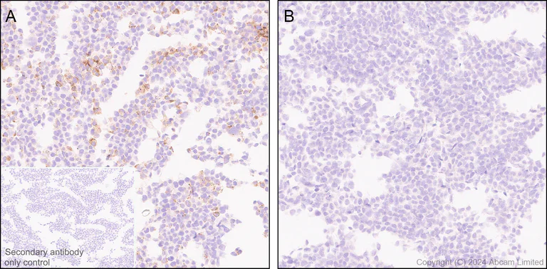 Immunohistochemistry (Formalin/PFA-fixed paraffin-embedded sections) - Anti-Streptavidin antibody [EPR28602-42] (AB319103)