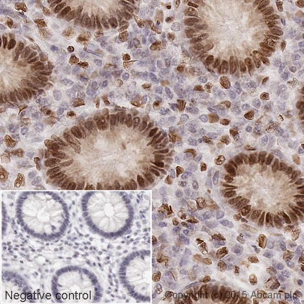 Immunohistochemistry (Formalin/PFA-fixed paraffin-embedded sections) - Streptavidin (HRP) (AB7403)