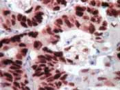 Immunohistochemistry (Formalin/PFA-fixed paraffin-embedded sections) - Streptavidin HRP (ready-to-use) (AB64269)