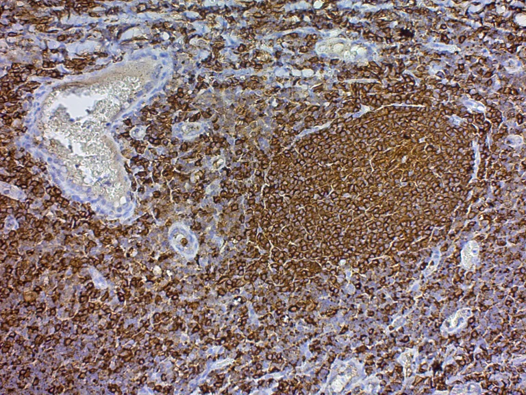 Immunohistochemistry (Formalin/PFA-fixed paraffin-embedded sections) - Streptavidin HRP (ready-to-use) (AB64269)