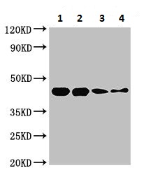 Western blot - Anti-Streptococcal Pyrogenic Exotoxin B antibody (AB225941), expandable thumbnail