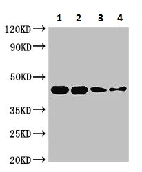 Western blot - Anti-Streptococcal Pyrogenic Exotoxin B antibody (AB225941)