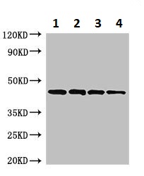 Western blot - Anti-Streptococcal Pyrogenic Exotoxin B antibody (AB234682)