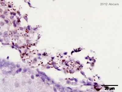 Immunohistochemistry (Formalin/PFA-fixed paraffin-embedded sections) - Anti-Streptococcus Group B antibody (AB53584)
